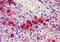 CD38 Molecule antibody, MBS242894, MyBioSource, Immunohistochemistry frozen image 