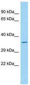 Olfactory Receptor Family 52 Subfamily A Member 5 antibody, TA332302, Origene, Western Blot image 