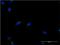 Acyl-CoA Binding Domain Containing 3 antibody, H00064746-M02, Novus Biologicals, Immunocytochemistry image 