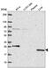 Phosphoribosyl Pyrophosphate Synthetase 2 antibody, NBP2-56594, Novus Biologicals, Western Blot image 