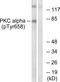 Protein Kinase C antibody, AP55716PU-S, Origene, Western Blot image 
