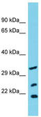 Solute Carrier Family 25 Member 17 antibody, TA332038, Origene, Western Blot image 