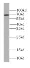 Putative Wiskott-Aldrich syndrome protein family member 4 antibody, FNab09469, FineTest, Western Blot image 