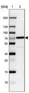 Catenin Beta Like 1 antibody, PA5-55725, Invitrogen Antibodies, Western Blot image 