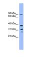 Phospholysine Phosphohistidine Inorganic Pyrophosphate Phosphatase antibody, orb326217, Biorbyt, Western Blot image 