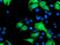 Serine/threonine-protein kinase Nek9 antibody, MA5-25650, Invitrogen Antibodies, Immunocytochemistry image 