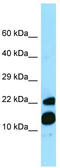 Morf4 Family Associated Protein 1 antibody, TA337947, Origene, Western Blot image 