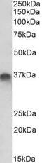 Syntaxin 11 antibody, PA5-37907, Invitrogen Antibodies, Western Blot image 