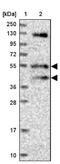Fuzzy Planar Cell Polarity Protein antibody, NBP1-82111, Novus Biologicals, Western Blot image 