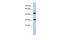 Transport And Golgi Organization 2 Homolog antibody, 31-297, ProSci, Western Blot image 