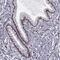 Zinc Finger Protein 19 antibody, NBP2-56078, Novus Biologicals, Immunohistochemistry paraffin image 