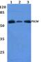 Phosphatidylinositol Glycan Anchor Biosynthesis Class W antibody, PA5-37196, Invitrogen Antibodies, Western Blot image 