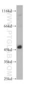 Tumor susceptibility gene 101 protein antibody, 14497-1-AP, Proteintech Group, Western Blot image 