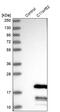 Chromosome 11 Open Reading Frame 52 antibody, PA5-58367, Invitrogen Antibodies, Western Blot image 