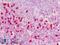 Carcinoembryonic Antigen Related Cell Adhesion Molecule 6 antibody, LS-B9075, Lifespan Biosciences, Immunohistochemistry frozen image 