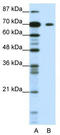 Kelch Like Family Member 26 antibody, TA345247, Origene, Western Blot image 