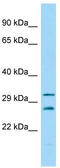 Casein kinase II subunit beta antibody, TA346545, Origene, Western Blot image 