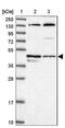 Tubulin Epsilon And Delta Complex 1 antibody, NBP1-85864, Novus Biologicals, Western Blot image 