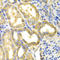 Dihydropyrimidine dehydrogenase [NADP+] antibody, LS-C335165, Lifespan Biosciences, Immunohistochemistry frozen image 