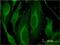 Leucine Rich Repeat Kinase 1 antibody, H00079705-M03, Novus Biologicals, Immunofluorescence image 