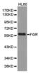FGR Proto-Oncogene, Src Family Tyrosine Kinase antibody, TA327258, Origene, Western Blot image 