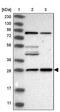 Mediator Complex Subunit 8 antibody, PA5-55850, Invitrogen Antibodies, Western Blot image 