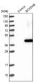Branched Chain Keto Acid Dehydrogenase E1 Subunit Beta antibody, NBP1-86326, Novus Biologicals, Western Blot image 