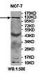 Ubiquitin carboxyl-terminal hydrolase 37 antibody, orb78162, Biorbyt, Western Blot image 