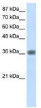 Kelch Domain Containing 8A antibody, TA343874, Origene, Western Blot image 