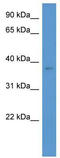 Calcium Voltage-Gated Channel Auxiliary Subunit Gamma 3 antibody, TA338562, Origene, Western Blot image 
