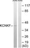 Potassium Two Pore Domain Channel Subfamily K Member 15 antibody, TA315706, Origene, Western Blot image 