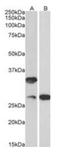 U6 SnRNA Biogenesis Phosphodiesterase 1 antibody, orb125251, Biorbyt, Western Blot image 
