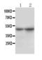 Sodium/bile acid cotransporter antibody, LS-C312823, Lifespan Biosciences, Western Blot image 
