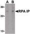 RPA Interacting Protein antibody, PA5-20326, Invitrogen Antibodies, Western Blot image 