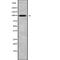 Doublesex- and mab-3-related transcription factor C2 antibody, abx149857, Abbexa, Western Blot image 