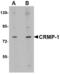 Collapsin Response Mediator Protein 1 antibody, LS-B3226, Lifespan Biosciences, Western Blot image 
