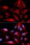 S100 Calcium Binding Protein A11 antibody, LS-B14896, Lifespan Biosciences, Immunofluorescence image 