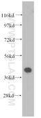 Parvin Alpha antibody, 11202-1-AP, Proteintech Group, Western Blot image 