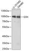 Gelsolin antibody, 18-880, ProSci, Western Blot image 