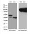 Proteasome 26S Subunit, Non-ATPase 5 antibody, M12220, Boster Biological Technology, Western Blot image 