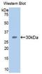 Semaphorin-5B antibody, LS-C304111, Lifespan Biosciences, Western Blot image 
