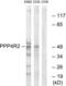 Protein Phosphatase 4 Regulatory Subunit 2 antibody, LS-C120380, Lifespan Biosciences, Western Blot image 