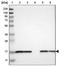 Cytochrome P450 Family 4 Subfamily F Member 2 antibody, NBP1-86461, Novus Biologicals, Western Blot image 