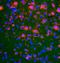 ACTH receptor antibody, orb10034, Biorbyt, Immunohistochemistry paraffin image 