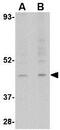 Retrograde Golgi transport protein RGP1 homolog antibody, GTX85404, GeneTex, Western Blot image 