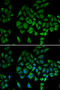 NADH:Ubiquinone Oxidoreductase Core Subunit S1 antibody, 16-802, ProSci, Immunofluorescence image 