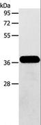 Aminoadipate-Semialdehyde Dehydrogenase-Phosphopantetheinyl Transferase antibody, LS-C401137, Lifespan Biosciences, Western Blot image 