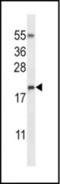 RNS3 antibody, orb314803, Biorbyt, Western Blot image 