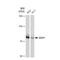 SUMO Specific Peptidase 1 antibody, GTX03252, GeneTex, Western Blot image 