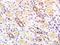 Seprase antibody, orb10942, Biorbyt, Immunohistochemistry paraffin image 